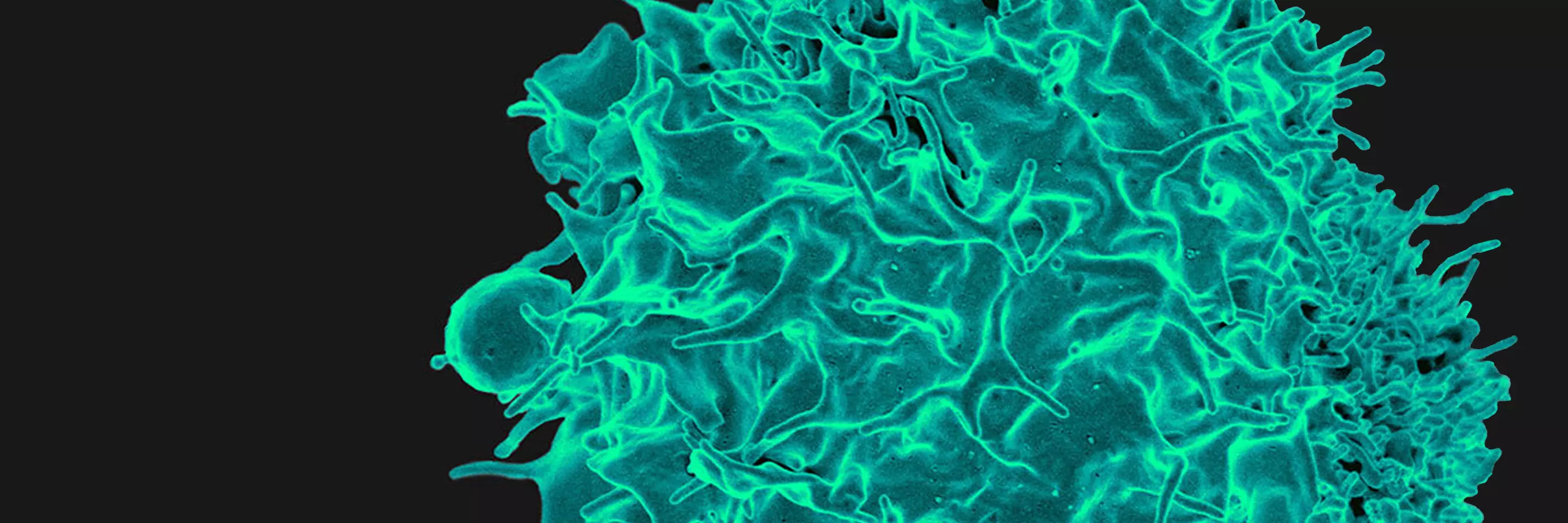 Placeholder image for Immunotherapy at MSK