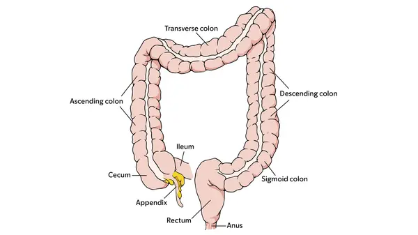 Image of the rectum, anus, different parts of the colon, cecum, appendix, and ileum. 